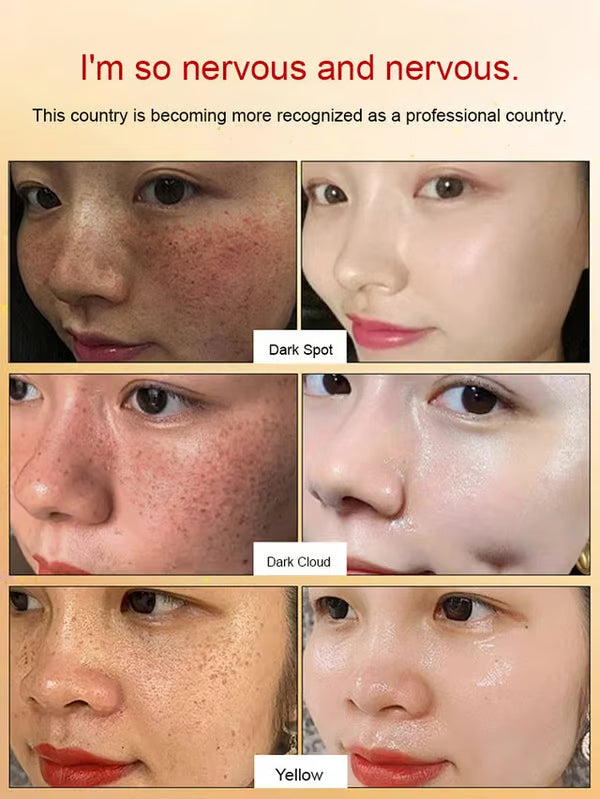 Whitening And Anti-Freckle Essence (BUY 1 GET 1 FREE)