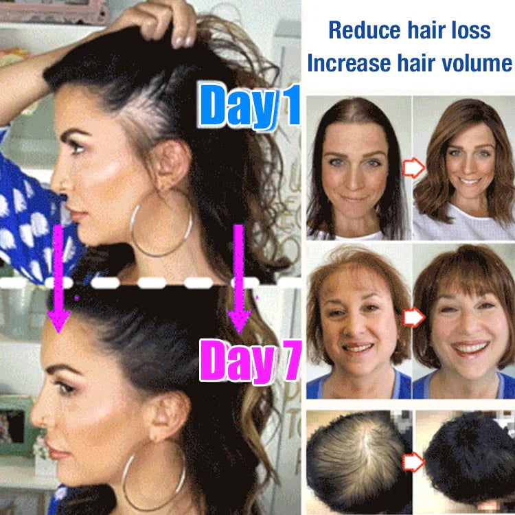 Anti-Hair Loss Serum (BUY 1 GET 1 FREE)
