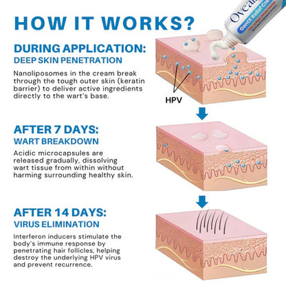 HPV Genital Warts Relief Cream (BUY 1 GET 1 FREE)