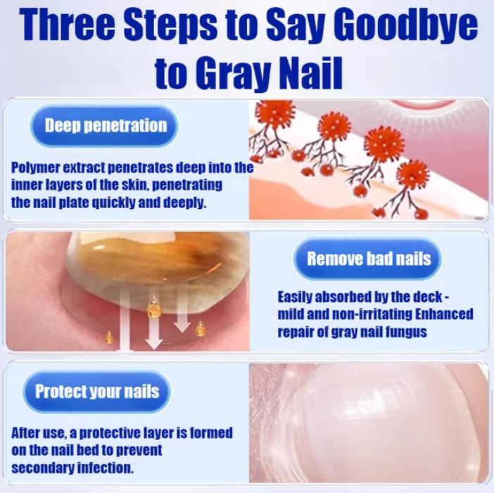 Fungal Nail Treatment Cream (BUY 1 GET 1 FREE)