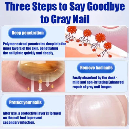 Fungal Nail Treatment Cream (BUY 1 GET 1 FREE)
