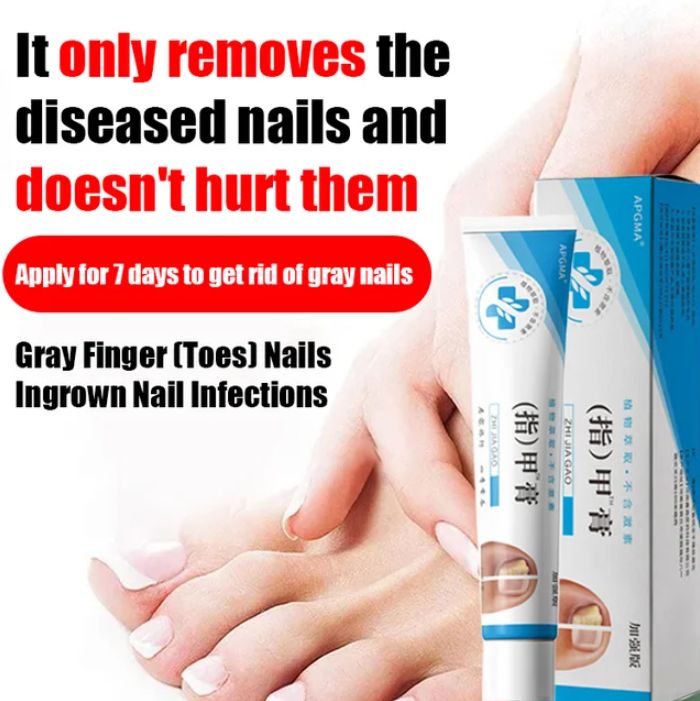 Fungal Nail Treatment Cream (BUY 1 GET 1 FREE)