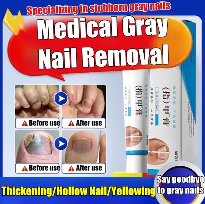 Fungal Nail Treatment Cream (BUY 1 GET 1 FREE)