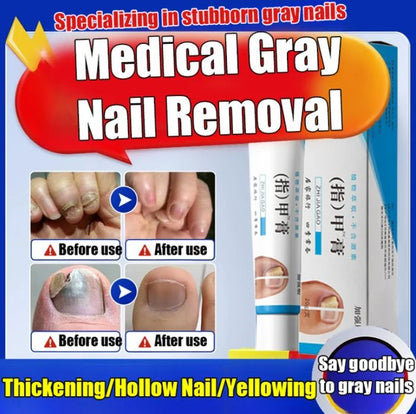 Fungal Nail Treatment Cream (BUY 1 GET 1 FREE)