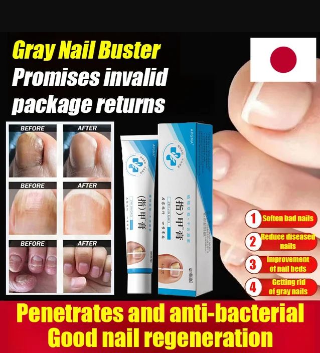 Fungal Nail Treatment Cream (BUY 1 GET 1 FREE)